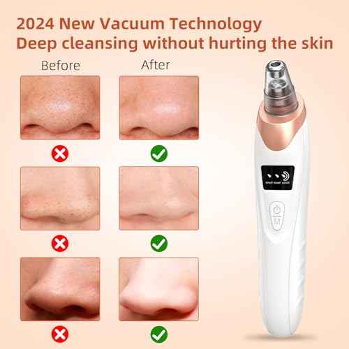 2025 Pore Vacuum, USB Rechargeable Blackhead Remover Vacuum,3 Levels Adjustable Pore Vacuum Blackhead Remover, with 5 Suction Power,6 Probes,Face Vacuum Pore Cleanser for Women & Men-White