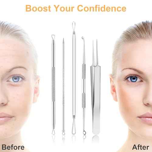 9 PCS Blackhead Remover Tools, Pimple Popper Tool Kit & Comedone Extractor - Professional Acne, Zit, Blemish & Whitehead Removal for Face & Nose, with Stainless Steel Tweezers & Travel Case, UUBAAR