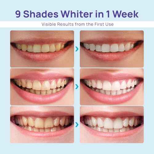 Whitebite Pro Teeth Whitening Kit for Sensitive Teeth ? Dual LED Light + 35% Carbamide Peroxide Gel + Remineralizing Gel | Dental-Grade Whitening at Home