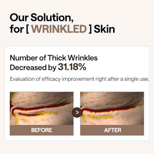 Mediheal Retinol Collagen Under Eye Patches - Korean Hydrogel Eye Pads (60 patches) with 95% Retinol & 5 Micro Collagen. Nourishing & Non Irritating Eye Gel Mask. Sealing Cap & Spatula Included.