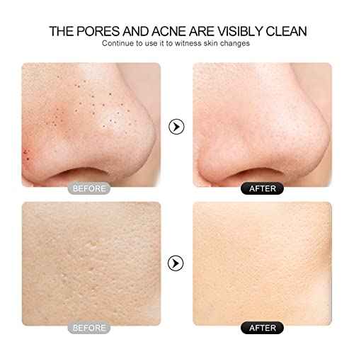 Face Scrubber Skin Spatula - Blackhead Remover with 4 Modes, Pore Extractor Face Spatula Deep Cleansing for Facial Skincare Women Gift