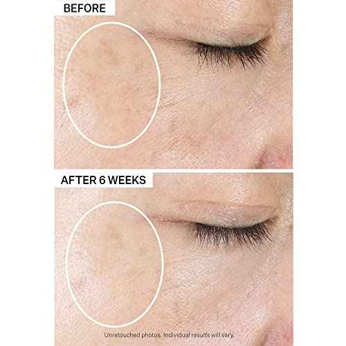 StriVectin Multi-Action Super-C SPF 30 Vitamin C Moisturizer and Daily Sunscreen for Brightening and Smoothing Fine Lines, 1.7 Fl Oz