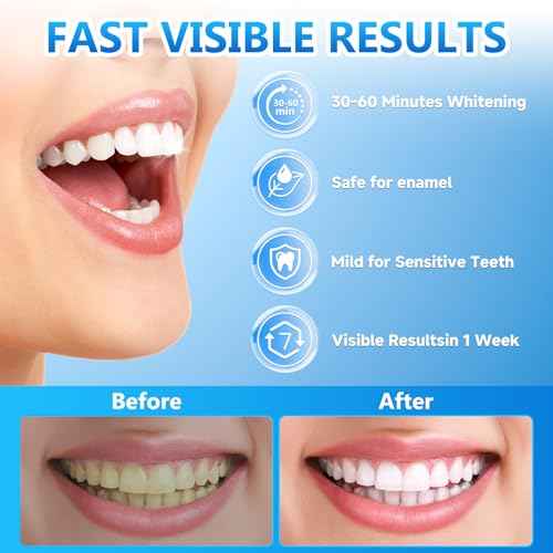 Teeth Whitening Strips for Sensitive, 42 Strips Whitener Safe Whitestrip, Deep Stains Removal Tooth Whitening, Enamel Safe Non-Slip Dry Strip Technology for Whiter Teeth, Mint