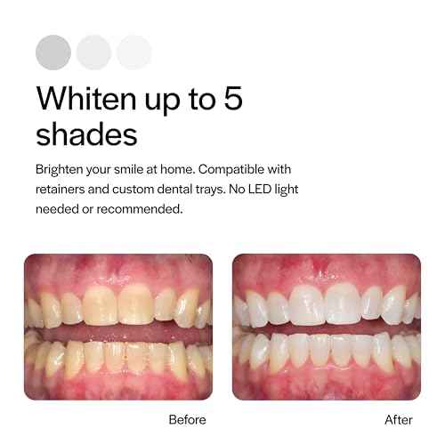 Opalescence 15% Gel Syringes Teeth Whitening Refill Kit - Low Sensivity (4 Syringes) - Cool Mint - Carbamide Peroxide - Made in The USA by Ultradent Tooth Whitening 5195-2
