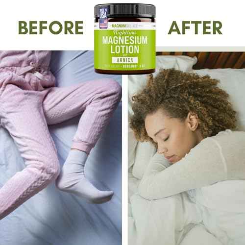 Nighttime Magnesium Lotion with Arnica ? Soothing Relief & Relaxation, Highly Concentrated Magnesium for Muscles & Joints ? Apply to Legs or Feet Before Bed ? Skin-Friendly