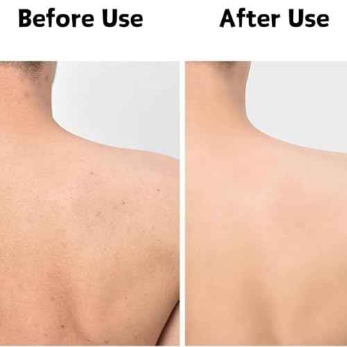 Blissal Exfoliating Shower Towel - Long Washcloth Back Body Scrubber for Men & Women (Black)