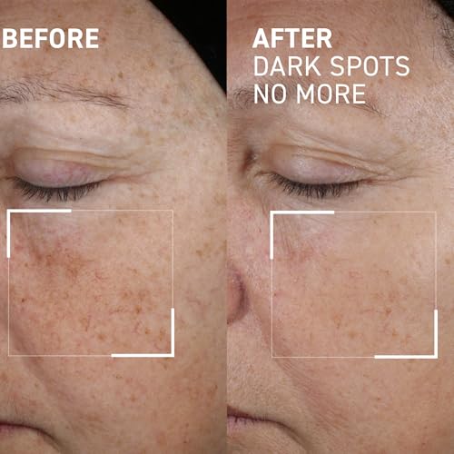 Dr. Brandt Bright This Way Dark Spots No More - Reduces Number, Intensity & Size of Pigmented Spots - 0.5 fl oz