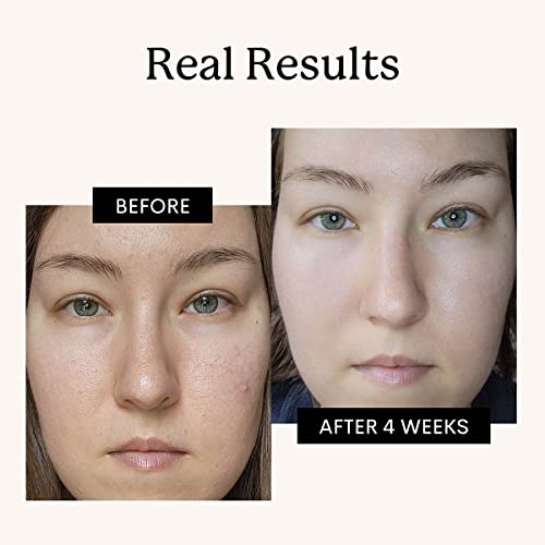 FLEUR & BEE Retinol Moisturizer | Clean, 100% Vegan | Anti Aging Cream, Retinol Cream for Face, Best for Night and Day, For Women and Men | Youth Fairy 1.5 oz