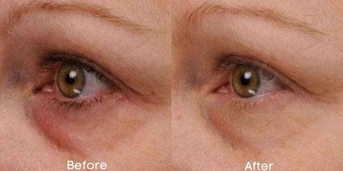 Replere - Renew & Firm Eye Serum