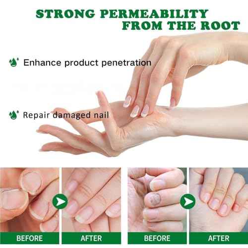 3PCS Ginger Nail Treatment, Nail Treatment, Ginger Cuticle Care Oil for Nails, Multi-Purpose Nail Oil