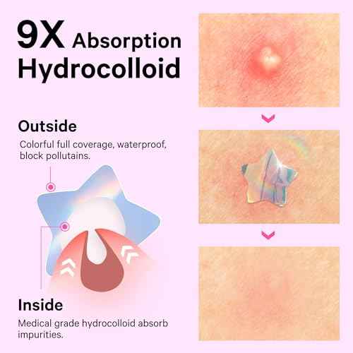 Sosky Hologram Pimple Patches for Face, Hydrocolloid Acne Patches with Salicylic Acid, Cute Star Zit Stickers,Colorful Blemish Covers,36 Count Pink Heart Moon Flower