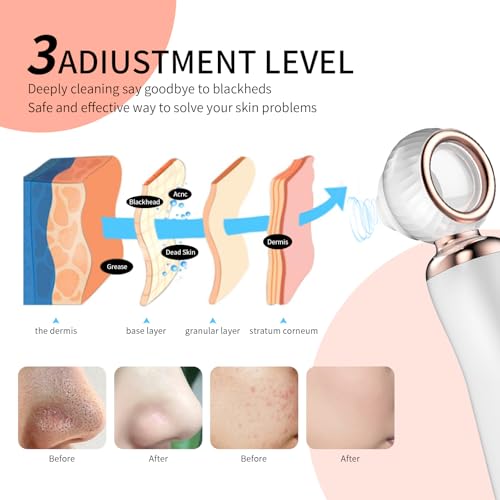 2025 Blackhead Remover Pore Vacuum, Visual Rechargeable Blackhead Vacuum Facial Pore Cleaner-3 Suction Soft Silicone,3 Probes,USB Kit Electric Acne Extractor Tool for Adult