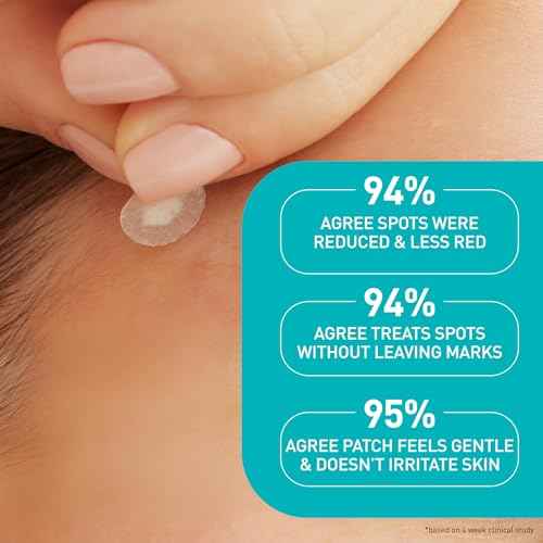 CeraVe Hydrocolloid Blemish Patches, Oil Absorbing Spot Control with Ceramides and Niacinamide, Allergy-Tested & Suitable For Sensitive Skin, Ultra-Thin & Blends Into All Skin Tones, 22ct