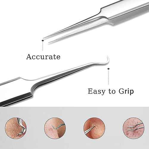 Professional Facial Blackhead Remover Tweezers,3Pcs Precision Pimple Popper Tool Kit for Whitehead Ance Blemishs Comedones Stainless Steel Makeup Tool - Matte
