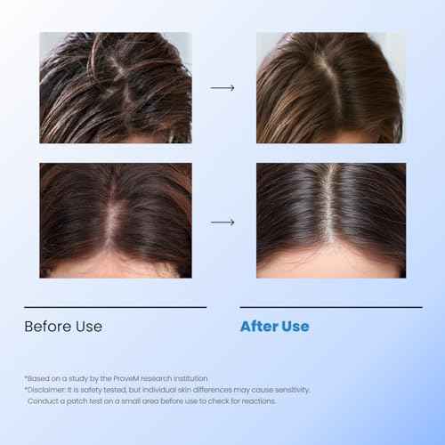 Leave-In Exfoliating Scalp Treatment - Detox Bubble Tonic for Dry & Itchy Scalp, Removes Flakes, Sebum & Buildup, Salicylic Acid & Menthol, Korean Hair Care