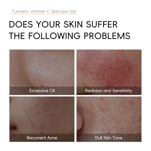 7PCS Turmeric Skin Care Set, Facial Skin Care Products Even Skin Tone, Turmeric Face Wash, Toner, Serum, Eye Cream, Face Cream, Face Mask, Smooth Glowing Travel Skincare Set for Women Girls