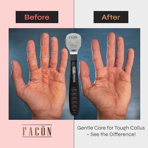 Fac?n Professional Callus Shaver Remover with 50 Blades, Pedicure Razor for Feet & Hands, Foot Razor for Callus Removal, Callus Blade Remover, Corn Shaver, Surgical Grade Premium Stainless Steel Tool
