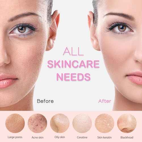 PRITECH Facial Cleansing Brush, Rechargeable Silicone Face Scrubber with Heat Massage End, Vibrating Exfoliator Scrubber for Deep Cleaning, Waterproof Face Brush for Women and Men (Pink)