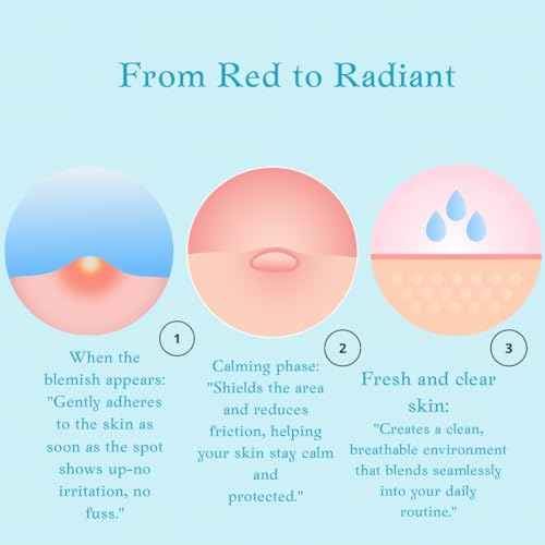 Dot by Nouf Acne Patch & Pimple Patches Fast Overnight Spot Treatment with Salicylic Acid & Tea Tree Oil Invisible Hydrocolloid, Ultra-Thin, Gentle 36 Count for Clear Skin