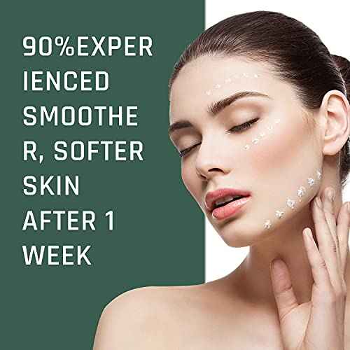 Urea Cream 40 Percent For Feet, Foot Cream, 40% Urea Lotion For Dry Skin/Cracked Heels/Ultra Calloused Feet, Softening Rough Skin On Feet, Skin Care with Glycerin, Jojoba for Men/Women, 4.3 oz