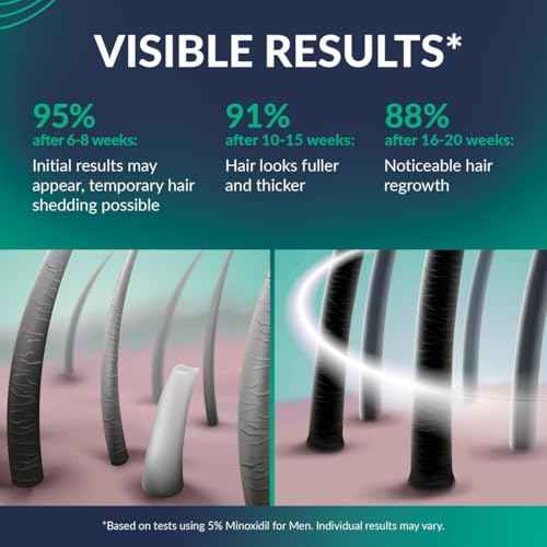 Minoxidil for Men 5% - Hair Growth, Beard Growth Kit Minoxidil 5 Percent + Vitamin E, Ginseng, Ginger Extract, Biotin Hair Growth Serum - Anti Hair Loss, Regrowth Treatment