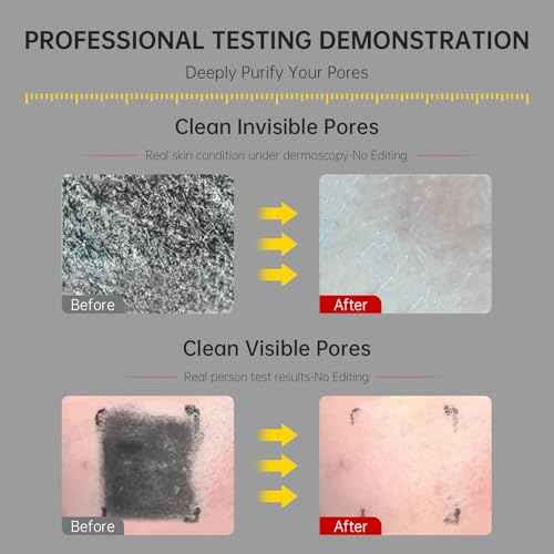 Gentle Exfoliating Face Wash for Deep Pore Cleanser and Blackhead Removal, Facial Cleanser for Oily Skin & Sensitive Skin, Double Cleansing Daily Facial Wash with Hyaluronic Acid + Glycerin, 3.52 Oz