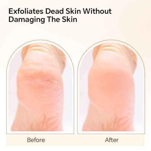 Nano Glass Foot File, Foot Callus Remover, Double Sided Pedicure Tools for Feet, Dual Use of Dry and Wet, Professional Hygienic Foot Scrubber to Achieve Smooth, Silky Feet Instantly (Golden)