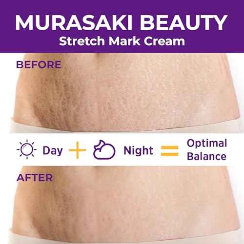 Stretch Mark Cream Prevention for Pregnancy - Maternity Cream for Stretch Marks Removal | Nourishing Formula ? Prevents Stretch Marks & Improves Elasticity - 4 oz (120g) (4 oz (120g))
