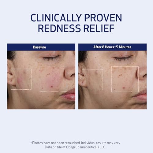 SUZANOBAGIMD Moisture Restore ? Medical-Grade Multi-Layered Moisture Provides Redness Relief, Long-Lasting Hydration + Improves Skin Texture & Firmness ? Suitable for All Skin Types ? 1.7 oz