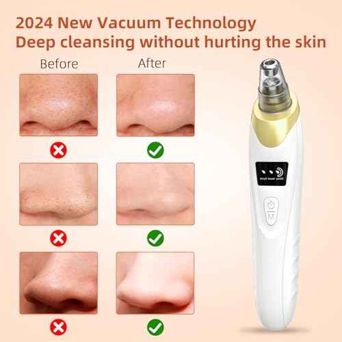 2025 Pore Vacuum, USB Rechargeable Blackhead Remover Vacuum,3 Levels Adjustable Pore Vacuum Blackhead Remover, with 5 Suction Power,6 Probes,Face Vacuum Pore Cleanser for Women & Men-Gold