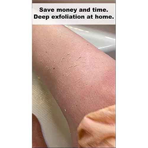 WATCH ME GLOW Silk Exfoliating Glove 100% Turkish Silk DEEP EXFOLIATING Body Scrubber Dead Skin Removal Body Exfoliator SMOOTHS SKIN and Keratosis Pilaris Exfoliating Mitt