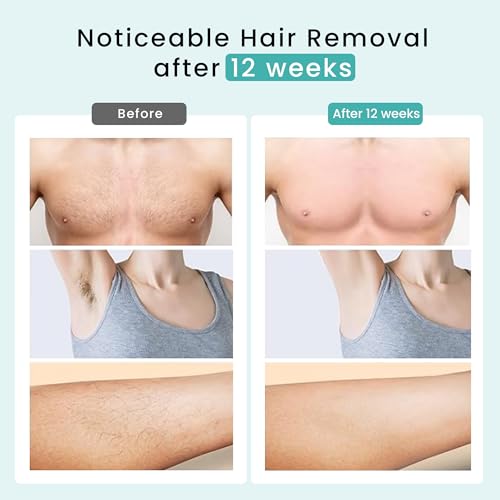 IPL Hair Removal Device for Women and Men, Hair Removal with Ice-Cooling, 5 Energy Levels, Home Use for Body & Face
