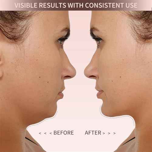 Eleve Beauty Face Shaper, Eleve Beauty V-Line Sculpting Face Mask, Chin Strap For Sleeping, Reusable Face Lift Chin Strap ? Silicone Double Chin Reducer For Jawline Tightening & Lifting (Classic Lift)