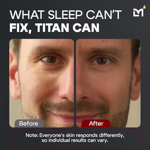 Titan Anti-Aging Mens Eye Cream ? Mens Dark Circles Under Eyes Treatment ? Eye Bags Treatment for Men ? Puffy Eyes Treatments for Men ? Peptides, HA, Herbal Extracts ?All Skin Types?Unscented