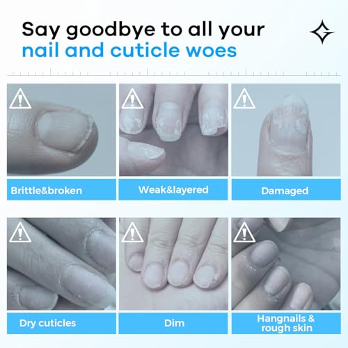 Hard Nail Strengthening Cream: Nail Strengthener and Cuticle Treatment to Repair &grow Split, Thin, Peeling Nails and Dry, Cracked Skin, Plant-Based Scent, 1 oz,Essential Manicure Nail Care