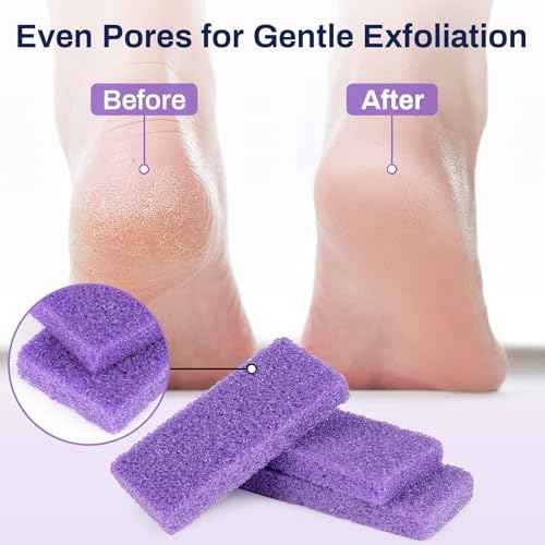 20 Small Pumice Stone for Feet - 3.6 X 1.8 X 0.47 Inch Purple Foot Pumice Stone Foot Filer Pedicura Scrubber for Callus Removal Foot Care Spa Productos for Dark Elbows Hard Skin Exfoliating