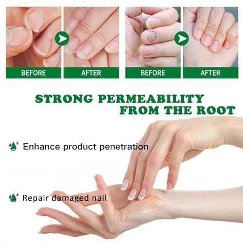 Ginger Nail Treatment Serum - Moisturize the Cuticle & Strengthen Nails and Helps Nails Healthy Grow, 1 fl.oz (Pack of 2)