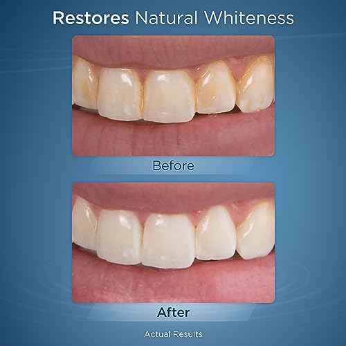 Waterpik Fresh Mint Whitening Refill Tablets (30 Count), Restore Natural Teeth Whiteness, Packaging May Vary, WT-30