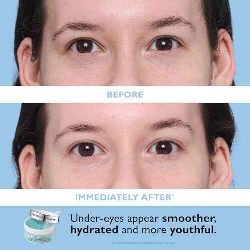 Peter Thomas Roth | Full-Size Vitamin C & Hyaluronic Eye Patches 2-Piece Kit
