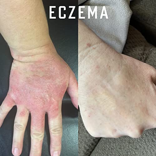 Pure Organic Ozonated Olive Oil Orginal Strength 800 Peroxide For Face and Skin Helps In Acne, Anti-Aging, Wrinkles and Rosacea For Sensitive Skin with Made in Spain