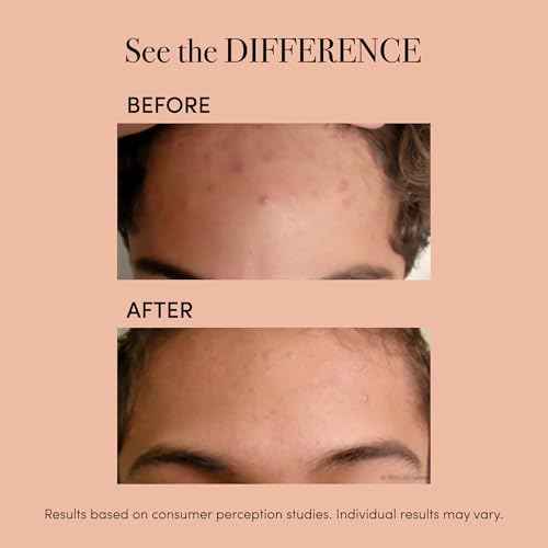 reVive Essentials Acne Device, FDA-cleared Red & Blue Light Acne Tools, Medspa Quality LED Light Therapy Products, Portable Triangular Design Face Tools for Skincare, Battery or USB Power