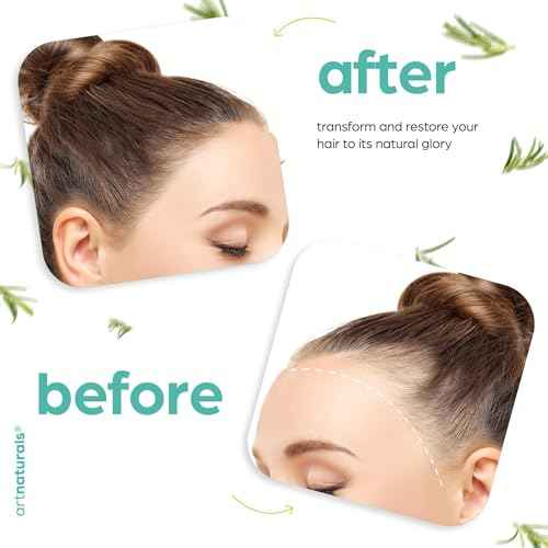 ArtNaturals Organic Rosemary & Castor Hair Growth Oil + Scalp Massager Set ? Hair Relaxer for Dry, Itchy Scalp, Thickening & Hydration - Scalp Oil Products For Damaged Hair & Split Ends ? 4.0 oz