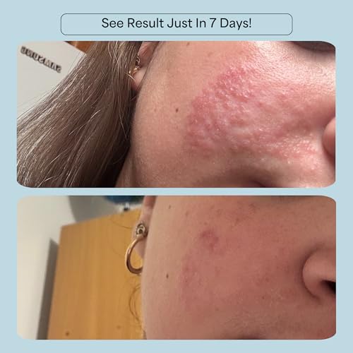 CelRevive B-Restore¢â Barrier Cream soothes, hydrates, and supports microbiome balance, restoring comfort to sensitive, dry skin. EWG Verified¢â for safety and transparency. Made in Australia