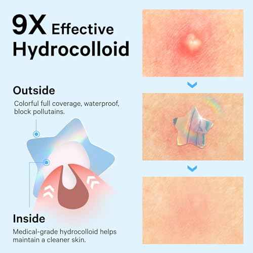 Sosky Hologram Pimple Patches for Face, Hydrocolloid Acne Patches with Salicylic Acid, Cute Star Zit Stickers,Colorful Blemish Covers,48 Count Blue Star Cloud