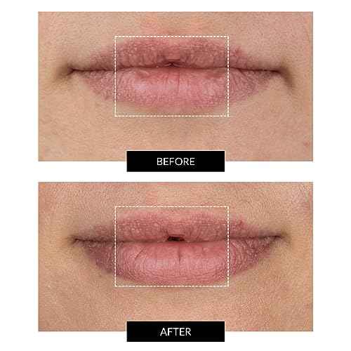 CurrentBody Skin LED Lip Perfector | Fully Wearable Anti-Aging Device for Lips | Soften Feather and Smile Lines for Plumper and Fuller Lips