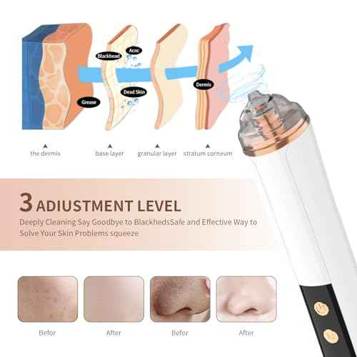 Blackhead Remover Pore Vacuum,Facial Pore Cleaner-6 Suction Power,3 Adjustable Suction Levels,USB Rechargeable Blackhead Vacuum Kit Electric Acne Extractor Tool for Women & Men (White)