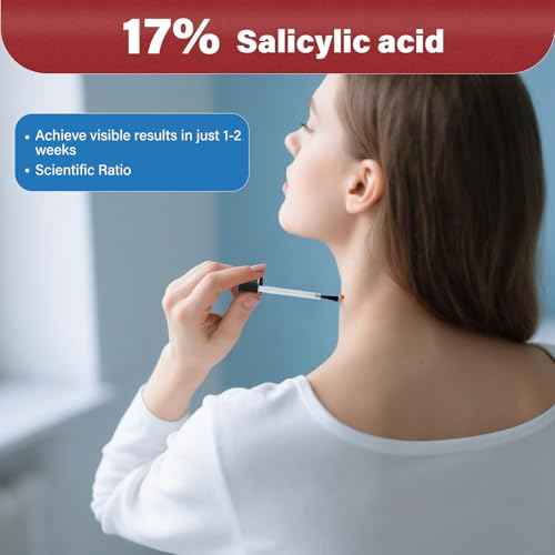 Goodnites Skin Tag Remover, Fast-Acting Gentle Salicylic Acid Formula Skin Tag Removal, Suitable for Neck, Underarms, Groin, Trusted by The Whole Family, 1 PCS