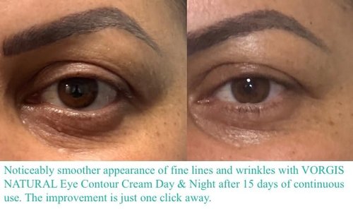 VORGIS NATURAL Eye Contour Cream Day & Night with Hyaluronic Acid.