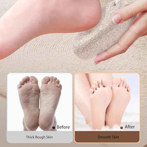 2PCS Natural Foot Pumice Stone£¬Natural Lava Pumice Stone for Feet, Foot Scrubber£¬Effective Pedicure Tools for Dead Skin and Callus Removal (Grey)
