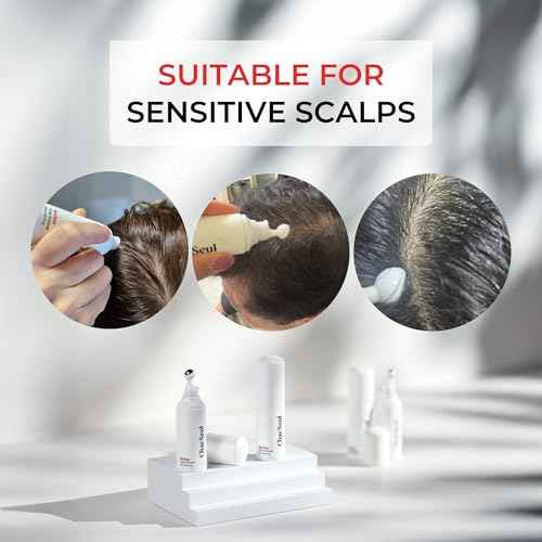 Revhan Scalp Serum for Hair Loss & Thinning ? Hair Growth Serum for Men & Women w/Salicylic Acid & Centella Asiatica ? Soothes Itchy, Irritated Scalp with Roll-On